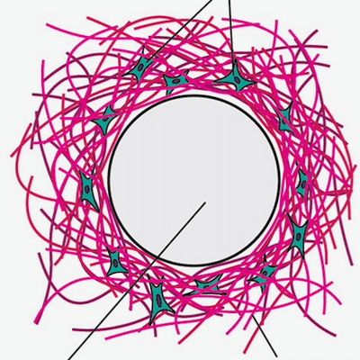 Graphic of a human cellular matrix surrounding a circular foreign body