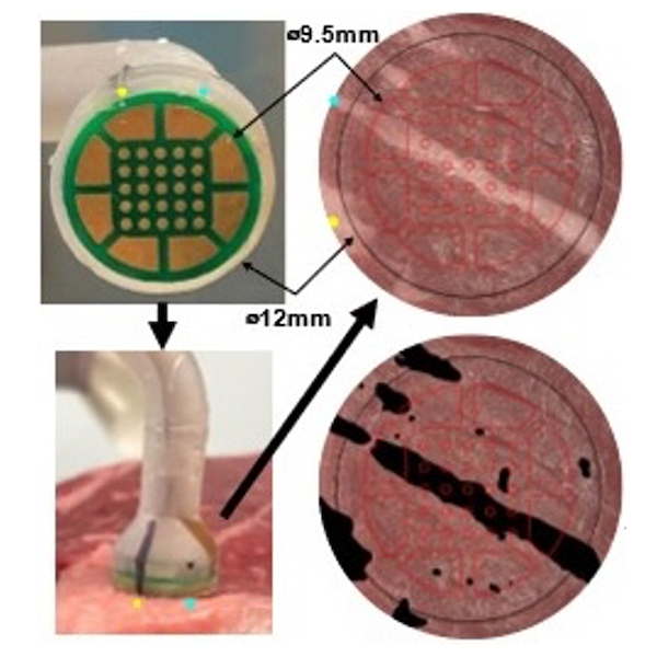 Electrode array and data collection figure