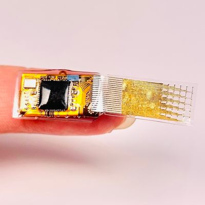 Implantable organ health monitor