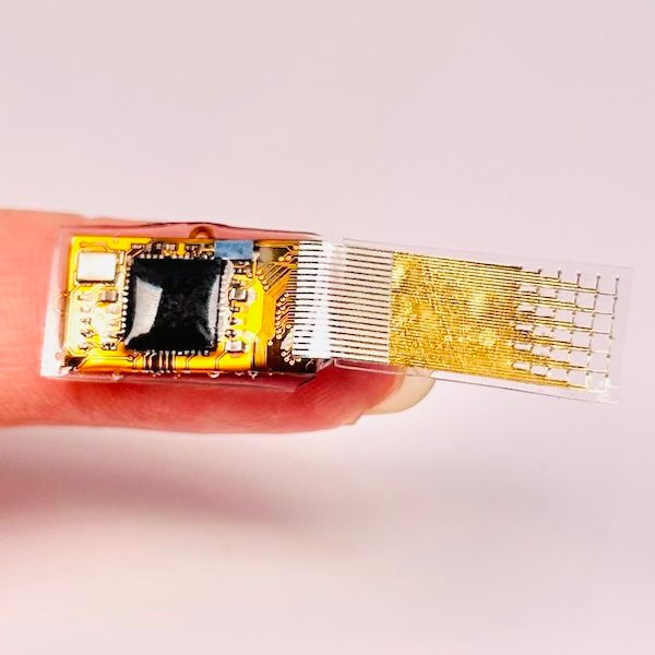 Implantable organ health monitor