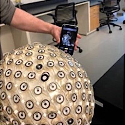 Using an iPhone to produce accurate high-density EEG scans for electrode localization